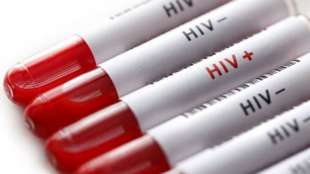La prueba para el autodiagnóstico del VIH ya está disponible en las farmacias sin necesidad de prescripción médica
