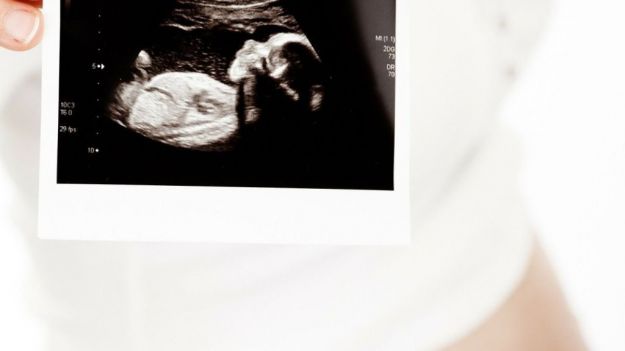 Un estudio revela que las embarazadas no transmiten el Covid-19 a los bebés