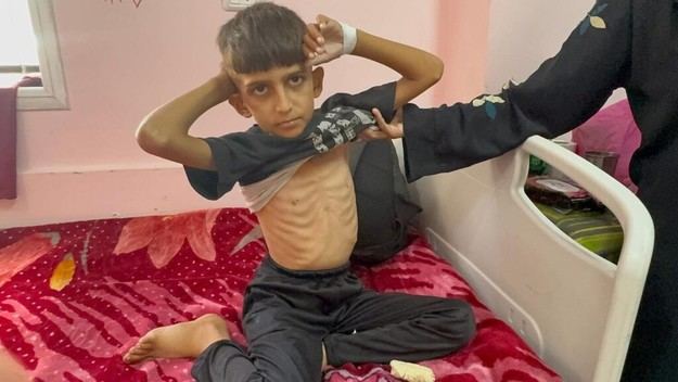 Crisis humanitaria en Gaza: la infancia sufre más que nunca
