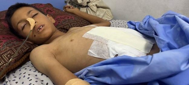 Crisis en Gaza: Hospitales colapsan y emergen enfermedades raras