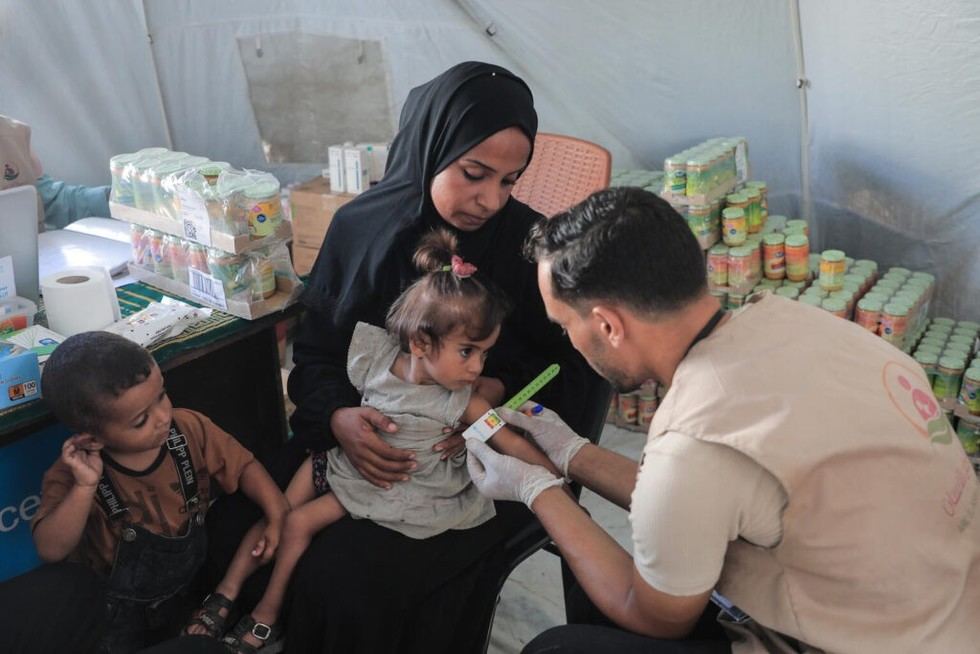 Desnutrición infantil en Gaza alcanza niveles alarmantes en agosto